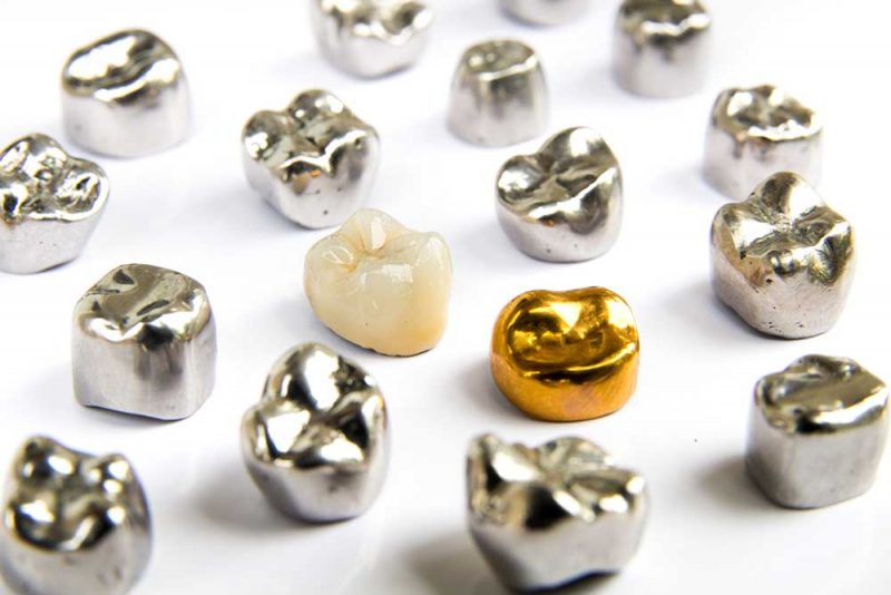dental-crowns-in-east-sussex Dental Crowns Bexhill East Sussex