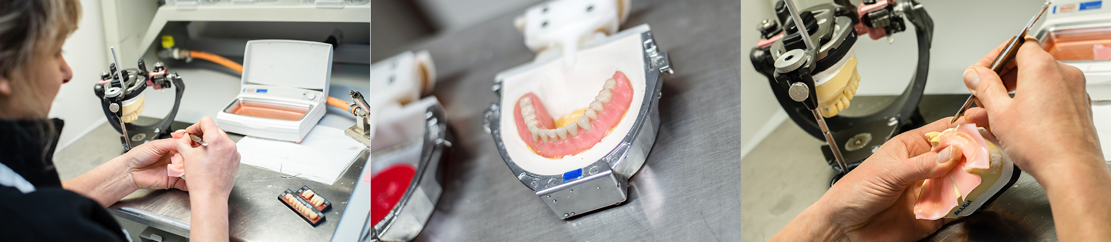 dental-technical-dentures-julia-burgess